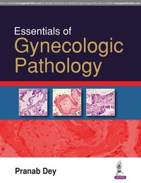 Produktbild: Essentials Of Gynecologic Pathology