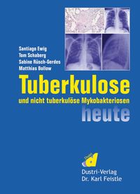 Produktbild: Tuberkulose und nicht tuberkul&ouml;se Mykobakteriosen heute