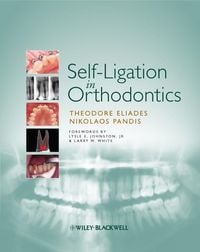 Produktbild: Self-Ligation in Orthodontics