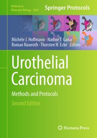 Produktbild: Urothelial Carcinoma