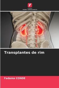 Produktbild: Transplantes de rim