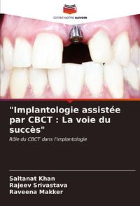 Produktbild: "Implantologie assist&eacute;e par CBCT : La voie du succ&egrave;s"