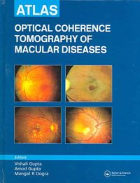 Produktbild: Gupta, A: Atlas, Optical Coherence Tomography of Macular Dis