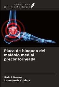 Produktbild: Placa de bloqueo del mal&eacute;olo medial precontorneada