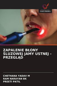 Produktbild: Zapalenie B&iquest;ony &iquest;luzowej Jamy Ustnej - Przegl&iquest;d