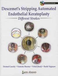 Produktbild: Descemet's Stripping Automated Endothelial Keratoplasty