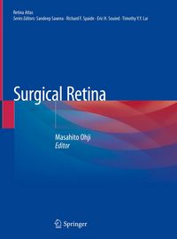 Produktbild: Surgical Retina