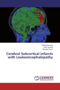 Produktbild: Cerebral Subcortical infarcts with Leukoencephalopathy
