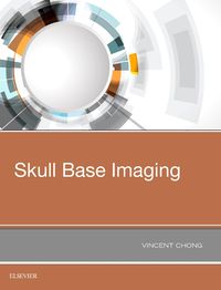 Produktbild: Skull Base Imaging