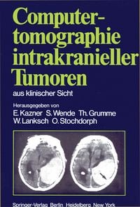 Produktbild: Computertomographie intrakranieller Tumoren aus klinischer Sicht
