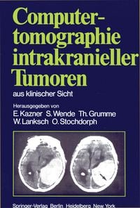 Produktbild: Computertomographie intrakranieller Tumoren aus klinischer Sicht