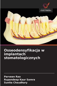 Produktbild: Osseodensyfikacja w implantach stomatologicznych