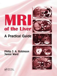 Produktbild: MRI of the Liver