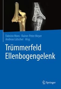 Produktbild: Tr&uuml;mmerfeld Ellenbogengelenk
