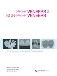 Produktbild: Prep Veneers und Non-Prep Veneers