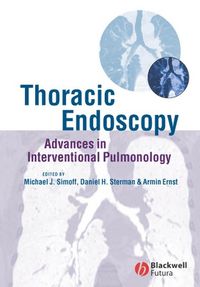 Produktbild: Thoracic Endoscopy