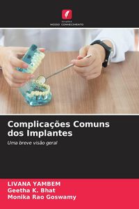 Produktbild: Complica&ccedil;&otilde;es Comuns dos Implantes