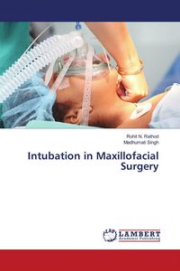 Produktbild: Intubation in Maxillofacial Surgery