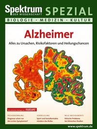 Bild vom Artikel Alzheimer vom Autor 