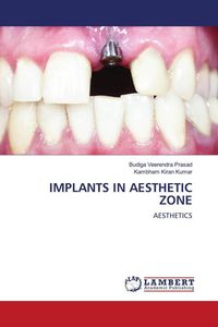 Produktbild: Implants in Aesthetic Zone