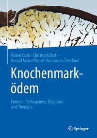 Produktbild: Knochenmark&ouml;dem