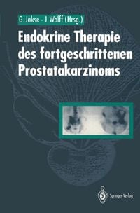 Produktbild: Endokrine Therapie des fortgeschrittenen Prostatakarzinoms