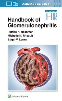 Produktbild: Handbook of Glomerulonephritis