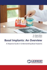 Produktbild: Basal Implants: An Overview
