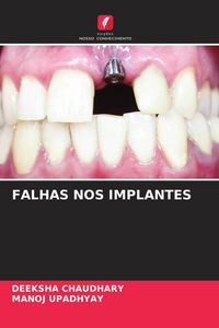 Produktbild: Falhas Nos Implantes