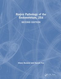Produktbild: Biopsy Pathology of the Endometrium, 2Ed