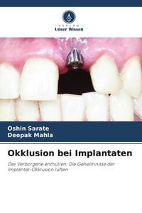 Produktbild: Okklusion bei Implantaten