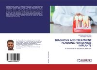 Produktbild: Diagnosis and Treatment Planning For Dental Implants