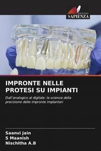 Produktbild: IMPRONTE NELLE PROTESI SU IMPIANTI