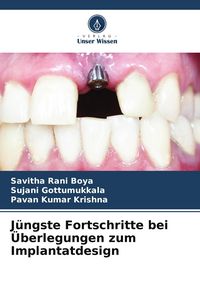 Produktbild: J&uuml;ngste Fortschritte bei &Uuml;berlegungen zum Implantatdesign