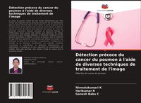 Produktbild: D&eacute;tection pr&eacute;coce du cancer du poumon &agrave; l'aide de diverses techniques de traitement de l'image