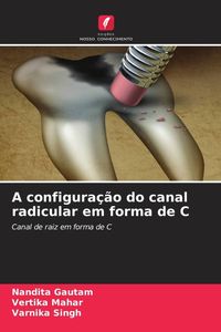 Produktbild: A configura&ccedil;&atilde;o do canal radicular em forma de C