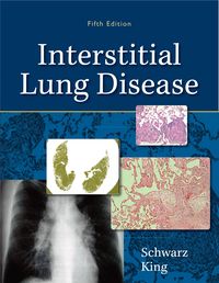 Produktbild: Interstitial Lung Disease