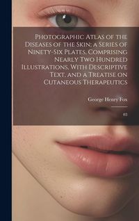 Produktbild: Photographic Atlas of the Diseases of the Skin; a Series of Ninety-six Plates, Comprising Nearly two Hundred Illustrations, With Descriptive Text, and