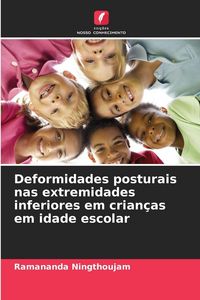 Produktbild: Deformidades posturais nas extremidades inferiores em crian&ccedil;as em idade escolar