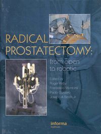 Produktbild: Radical Prostatectomy