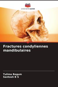 Produktbild: Fractures condyliennes mandibulaires