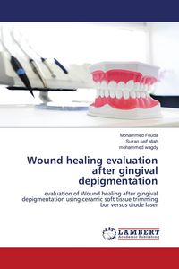 Produktbild: Wound healing evaluation after gingival depigmentation