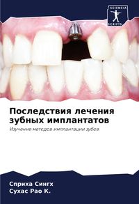 Produktbild: Posledstwiq lecheniq zubnyh implantatow