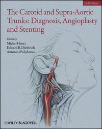 Produktbild: The Carotid and Supra-Aortic Trunks