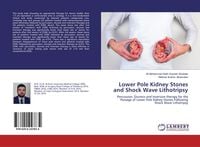 Produktbild: Lower Pole Kidney Stones and Shock Wave Lithotripsy