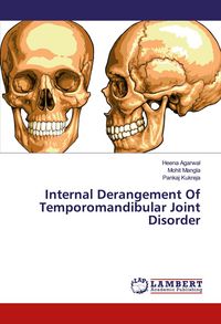 Produktbild: Internal Derangement Of Temporomandibular Joint Disorder