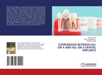 Produktbild: Comparison Between All On 4 and All On 6 Dental Implants