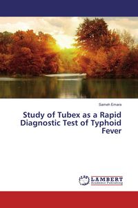Produktbild: Study of Tubex as a Rapid Diagnostic Test of Typhoid Fever