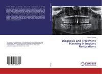 Produktbild: Diagnosis and Treatment Planning in Implant Restorations