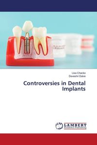 Produktbild: Controversies in Dental Implants